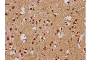 IHC image of ABIN7165594 diluted at 1:300 and staining in paraffin-embedded human brain tissue performed on a Leica BondTM system. (FEV anticorps  (AA 1-97))