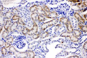 ACSL1 was detected in paraffin-embedded sections of mouse kidney tissues using rabbit anti- ACSL1 Antigen Affinity purified polyclonal antibody (Catalog # ) at 1 µg/mL.