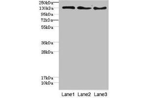 Western blot All lanes: RBP2antibody at 1. (RBP2 anticorps  (AA 1-134))