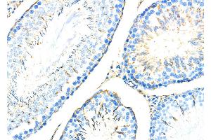 ABIN6259048 and ABIN6274810 at 1/100 staining Rat brain tissue by IHC-P. (ADAM32 anticorps  (C-Term))