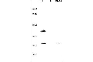 Lane 1: mouse testis lysates Lane 2: mouse brain lysates probed with Anti RSPO1 Polyclonal Antibody, Unconjugated (ABIN715451) at 1:200 in 4 °C. (RSPO1 anticorps)