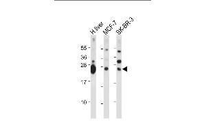 All lanes : Anti-GSTM4 Antibody (N-term) at 1:2000 dilution Lane 1: Human liver tissue lysate Lane 2: MCF-7 whole cell lysate Lane 3: SK-BR-3 whole cell lysate Lysates/proteins at 20 μg per lane. (GSTM4 anticorps  (N-Term))