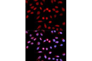 Immunofluorescence analysis of U2OS cells using PPP1CA antibody.