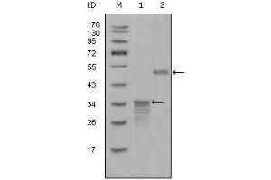Western blot analysis using Mammaglobin-1 mouse mAb against full-length GST- Mammaglobin-1 (1) and full-length MBP- Mammaglobin-1 (aa1-193) recombinant protein (2). (Mammaglobin A anticorps)