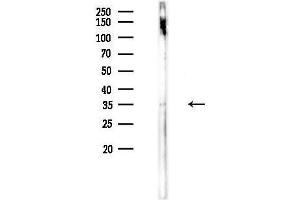 Western blot analysis of lysates from HepG2 cells(UV,30 min treatment), using P2RY6 Antibody at 1/1000 dilution.