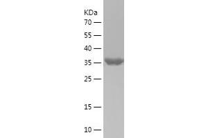 Western Blotting (WB) image for Mitogen-Activated Protein Kinase Kinase 4 (MAP2K4) (AA 1-144) protein (His-IF2DI Tag) (ABIN7124001)