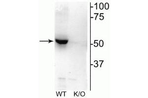 Western blot of mouse habenula lysate showing specific immunolabeling of the ~52 kDa nAChRβ2 protein. (CHRNB2 anticorps  (Cytoplasmic Loop))