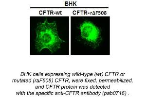 Image no. 1 for anti-Cystic Fibrosis Transmembrane Conductance Regulator (ATP-Binding Cassette Sub-Family C, Member 7) (CFTR) (N-Term) antibody (ABIN559718) (CFTR anticorps  (N-Term))