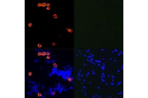 Immunofluorescence analysis of 293T cells transfected with SARS-Cov-2 3CLpro and untreated 293T cells using SARS-CoV-2 3CLpro Rabbit mAb (ABIN7270150) at dilution of 1:100/1:400/1:800(40x lens). (SARS-Coronavirus Nonstructural Protein 8 (SARS-CoV NSP8) anticorps)