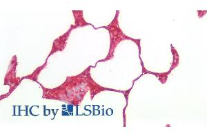 Detection of S100A6 in Human Lung Tissue using Polyclonal Antibody to S100 Calcium Binding Protein A6 (S100A6)