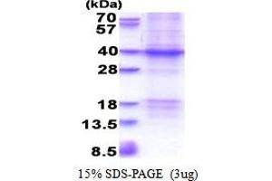 SDS-PAGE (SDS) image for X-Ray Repair Complementing Defective Repair in Chinese Hamster Cells 2 (XRCC2) (AA 1-280) protein (His tag) (ABIN5853479)