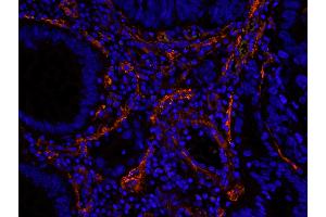 Immunofluorescence (IF) image for anti-Filamin A, alpha (FLNA) (AA 1725-1775) antibody (ABIN7448965)