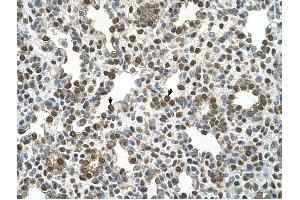 OSBPL9 antibody was used for immunohistochemistry at a concentration of 4-8 ug/ml to stain Alveolar cells (arrows) in Human Lung. (OSBPL9 anticorps  (N-Term))