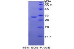 SDS-PAGE analysis of Mouse TRADD Protein.