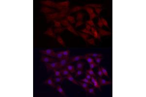 Immunofluorescence analysis of NIH/3T3 cells using WDR45 Rabbit pAb (ABIN6133064, ABIN6150194, ABIN6150195 and ABIN6223490) at dilution of 1:100 (40x lens). (WDR45 anticorps  (AA 1-360))