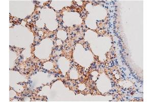 ABIN6267485 at 1/200 staining Mouse lung tissue sections by IHC-P.