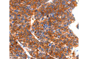 Immunohistochemistry (IHC) image for anti-Septin 4 (SEPT4) antibody (ABIN2432616) (Septin 4 anticorps)