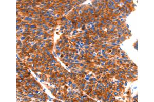 Immunohistochemistry (IHC) image for anti-Septin 4 (SEPT4) antibody (ABIN2432617) (Septin 4 anticorps)