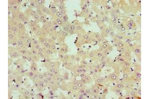 Immunohistochemistry of paraffin-embedded human liver tissue using ABIN7168990 at dilution of 1:100