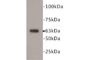 Western Blotting (WB) image for anti-5'-Nucleotidase, Ecto (CD73) (NT5E) antibody (ABIN1854862) (CD73 anticorps)