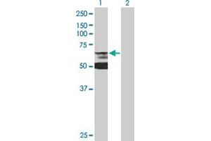 Western Blot analysis of LBR expression in transfected 293T cell line by LBR MaxPab polyclonal antibody. (Lamin B Receptor anticorps  (AA 1-615))
