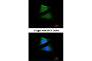 ICC/IF Image Immunofluorescence analysis of paraformaldehyde-fixed HeLa, using Seladin 1, antibody at 1:200 dilution.