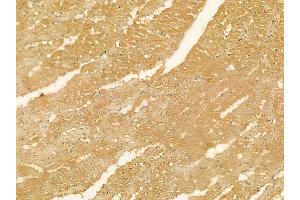 CDK5RAP1 Mouse Monoclonal Antibody at 1/100 staining rat heart tissue by IHC-P. (CDK5RAP1 anticorps  (C-Term))