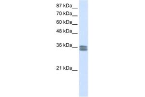 Western Blotting (WB) image for anti-Calcium Channel, Voltage-Dependent, gamma Subunit 4 (CACNG4) antibody (ABIN2461575)