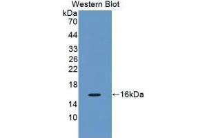 WB of Protein Standard: different control antibodies against Highly purified E. (GAD Kit ELISA)