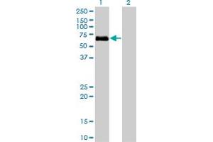 Western Blot analysis of BMPR1A expression in transfected 293T cell line by BMPR1A monoclonal antibody (M01), clone 4C4. (BMPR1A anticorps  (AA 1-532))