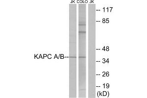 Western Blotting (WB) image for anti-KAPC A/B (N-Term) antibody (ABIN1849204) (KAPC A/B (N-Term) anticorps)