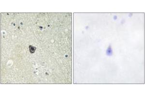 Immunohistochemistry analysis of paraffin-embedded human brain tissue, using CSFR (Ab-809) Antibody.