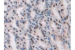 Detection of TALDO1 in Mouse Stomach Tissue using Polyclonal Antibody to Transaldolase (TALDO1)