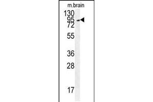 Western blot analysis in mouse brain tissue lysates (35ug/lane).