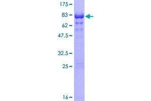 Image no. 1 for Telomeric Repeat Binding Factor 2, Interacting Protein (TERF2IP) (AA 1-399) protein (GST tag) (ABIN1322481)