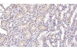 Detection of DTYMK in Porcine Kidney Tissue using Monoclonal Antibody to Deoxythymidylate Kinase (DTYMK)