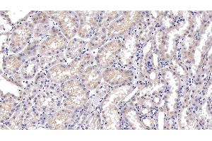 Detection of DTYMK in Porcine Kidney Tissue using Monoclonal Antibody to Deoxythymidylate Kinase (DTYMK) (DTYMK anticorps  (AA 43-190))