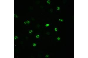 Immunofluorescence staining of A549 cells(treated with 100 ng/mL EGF for 20 min) with ABIN7127690 at 1:100,counter-stained with DAPI.