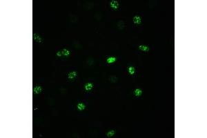 Immunofluorescence staining of A549 cells(treated with 100 ng/mL EGF for 20 min) with ABIN7127690 at 1:100,counter-stained with DAPI. (Recombinant EIF2S1 anticorps  (pSer51))