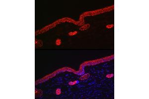 Immunofluorescence analysis of rat skin using Cytokeratin 16 (KRT16) Rabbit pAb (ABIN6129541, ABIN6143021, ABIN6143022 and ABIN6223391) at dilution of 1:200 (40x lens). (KRT16 anticorps  (AA 190-430))