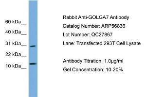 WB Suggested Anti-GOLGA7  Antibody Titration: 0. (Golgin A7 anticorps  (N-Term))