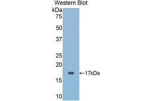 Western blot analysis of the recombinant protein. (GLRX3 anticorps  (AA 144-234))