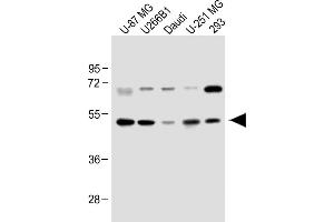 All lanes : Anti-WDR41 Antibody (C-term) at 1:1000 dilution Lane 1: U-87 MG whole cell lysate Lane 2: U266B1 whole cell lysate Lane 3: Daudi whole cell lysate Lane 4: U-251 MG whole cell lysate Lane 5: 293 whole cell lysate Lysates/proteins at 20 μg per lane. (WDR41 anticorps  (C-Term))