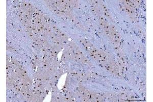 IHC analysis of CHD1 using anti-CHD1 antibody (ABIN7602361). (CHD1 anticorps  (AA 71-1250))