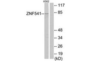 Western Blotting (WB) image for anti-Zinc Finger Protein 541 (ZNF541) (AA 931-980) antibody (ABIN2889752) (ZNF541 anticorps  (AA 931-980))