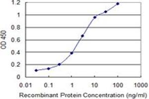 Detection limit for recombinant GST tagged MAGEB6 is 0.