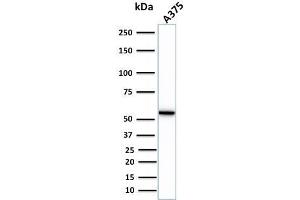 Western Blot Analysis of human A375 cell lysate using Vimentin Rabbit Recombinant Monoclonal Antibody (VIM/1937R).