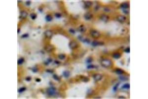 Used in DAB staining on fromalin fixed paraffin-embedded Kidney tissue (Decorin anticorps  (AA 31-359))
