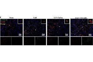 Autophagy of mice brain and neuron with the administration of COG1410.