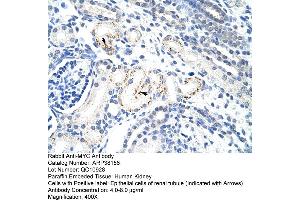 Human kidney (c-MYC anticorps  (N-Term))